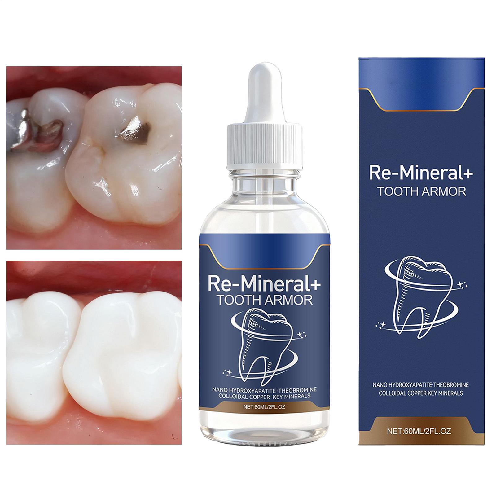 Teeth Whitening And Stain Removal - 60 ml tandenreinigingsvloeistof verwijdert tandvlekken Tanden