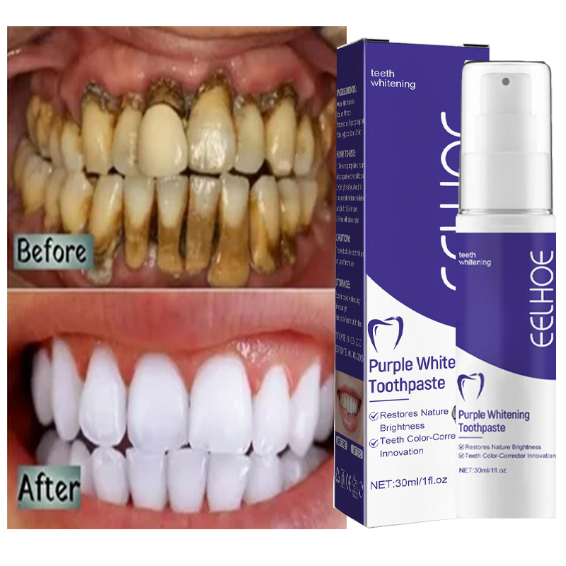 Teeth Whitening In Korea - 1 Stuks Tanden Reinigen Tandpasta Bleken