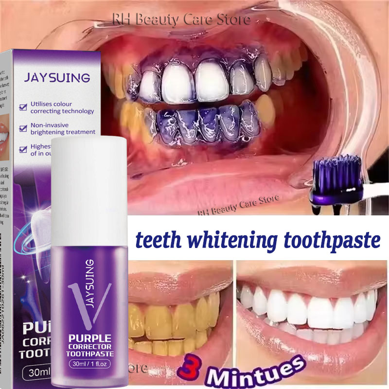 Teeth Whitening In Korea - Tandenreiniging Whitening Tandpasta Whitening Gel Whitener