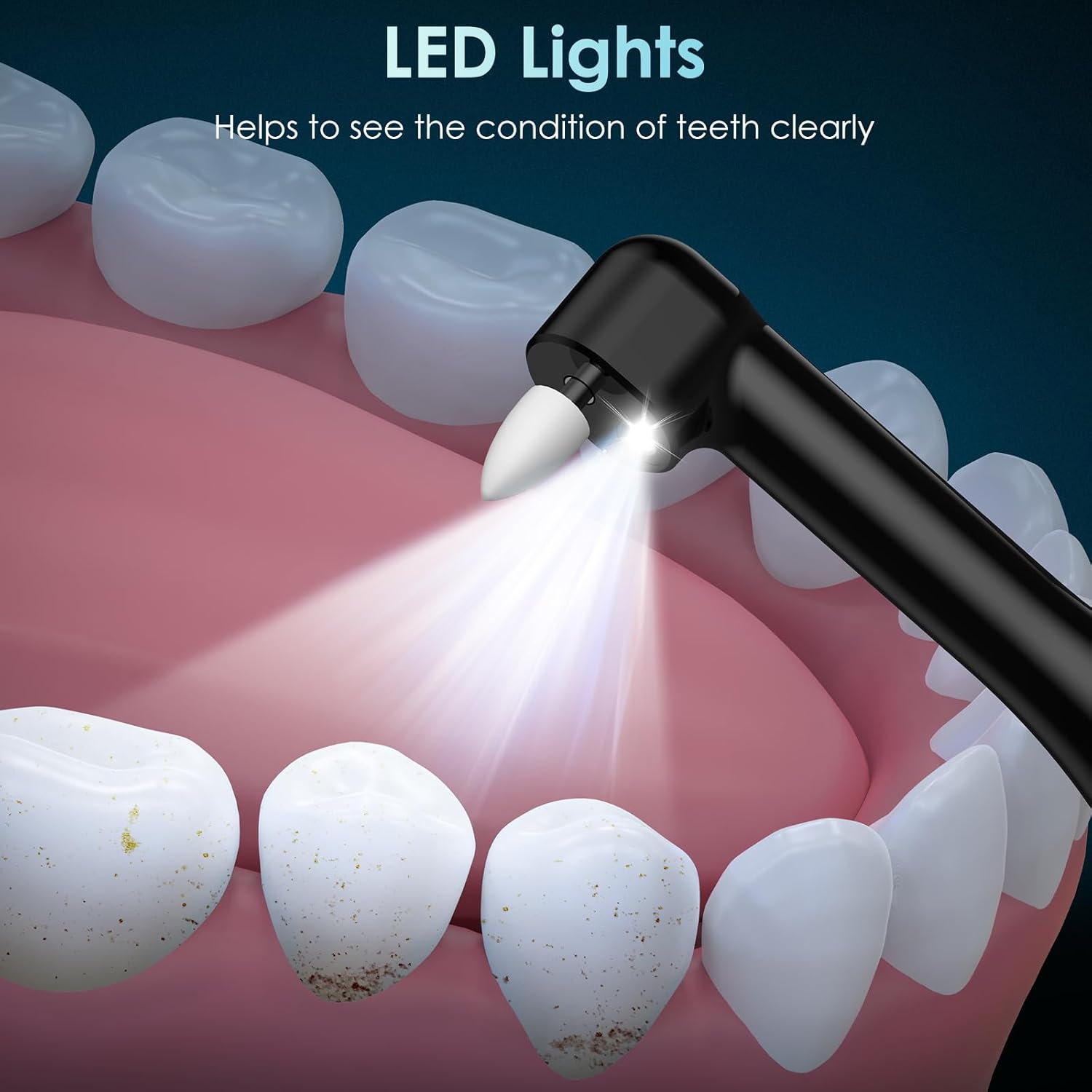 Tandpolijstmachine Oplaadbare  - Teeth Whitening Or Tooth Whitening recensie en prijs