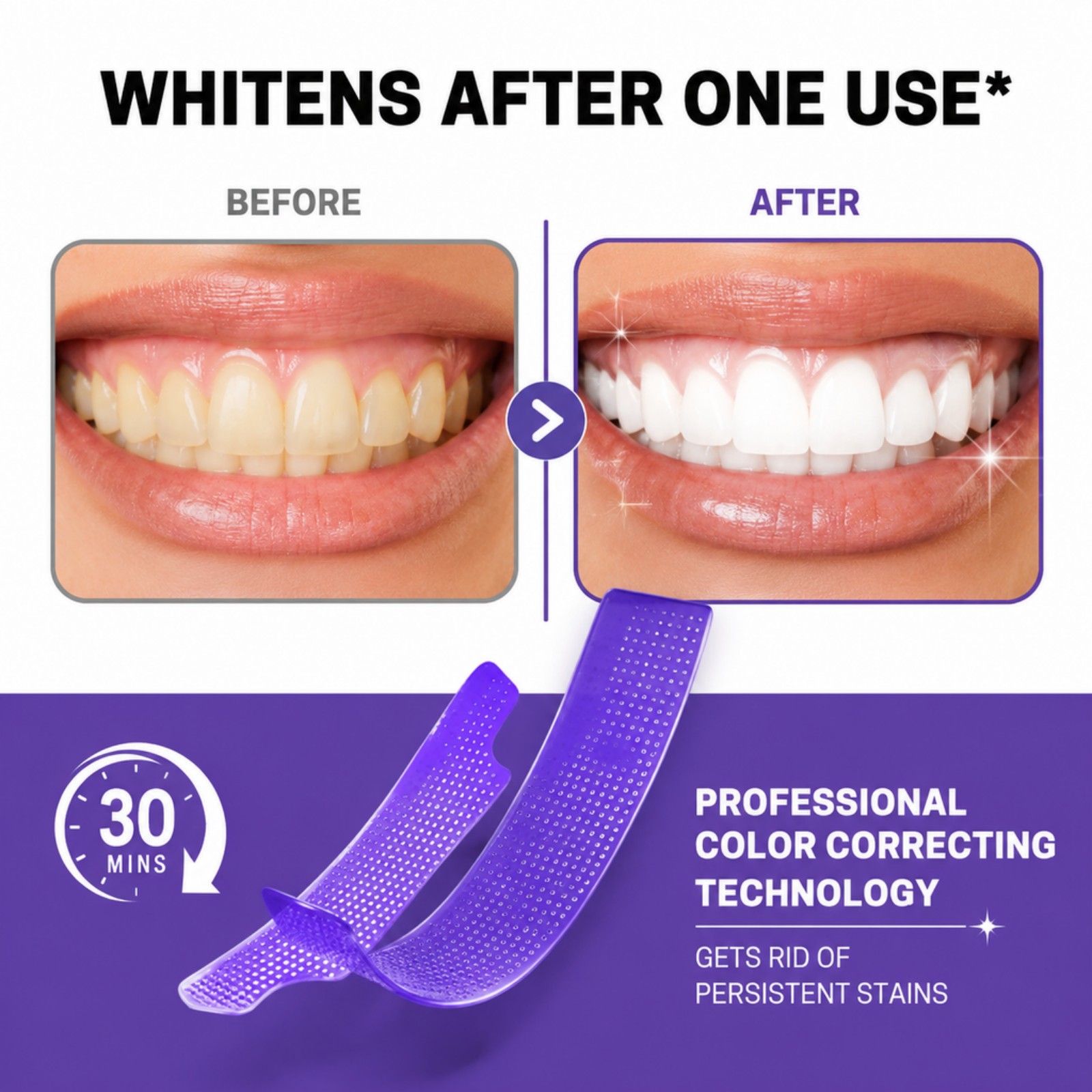 7/14/21/28 STUKS Paarse Tanden - Whitening Strip 3D recensie en prijs