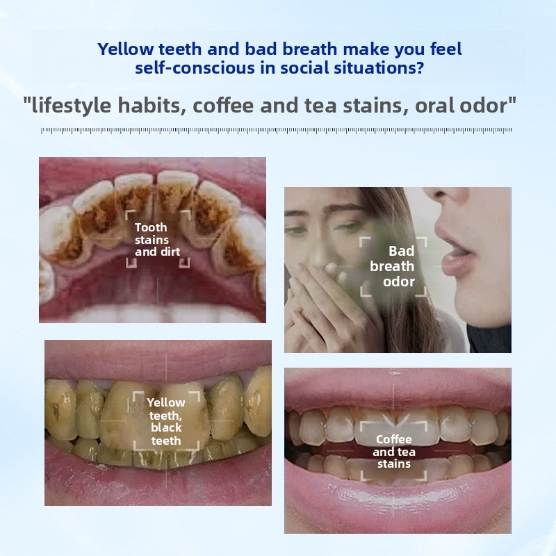 Enzymatisch verhelderend en wi - Teeth Whitening Enzymes recensie en prijs