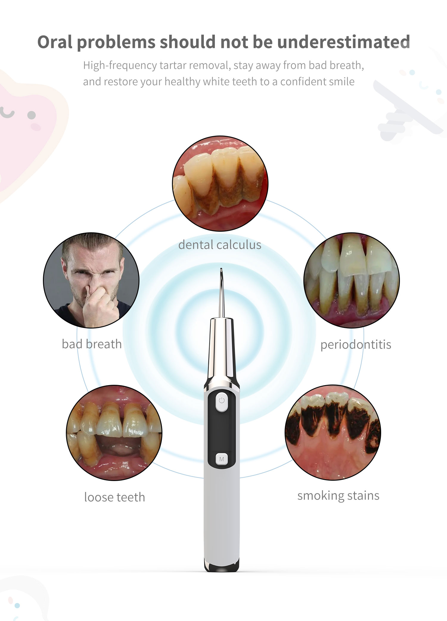 Elektrische Sonic Tandsteen Sc - Teeth Whitening Or Tooth Whitening recensie en prijs