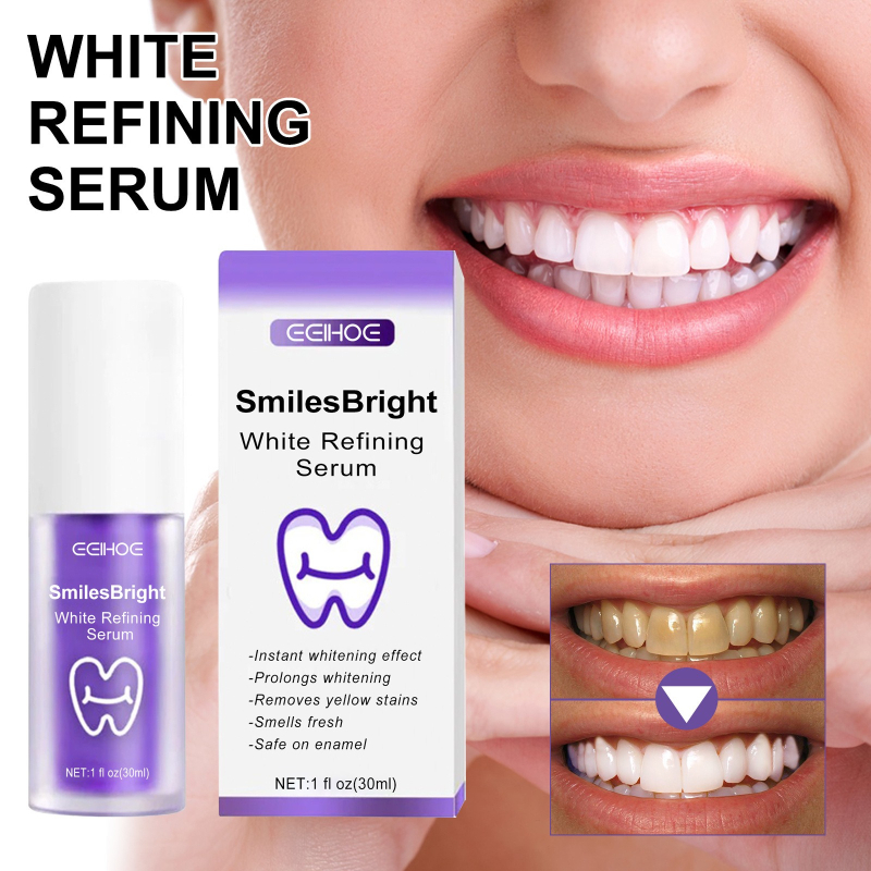 Tanden Reiniging Whitening Tan - Teeth Whitening In Korea recensie en prijs