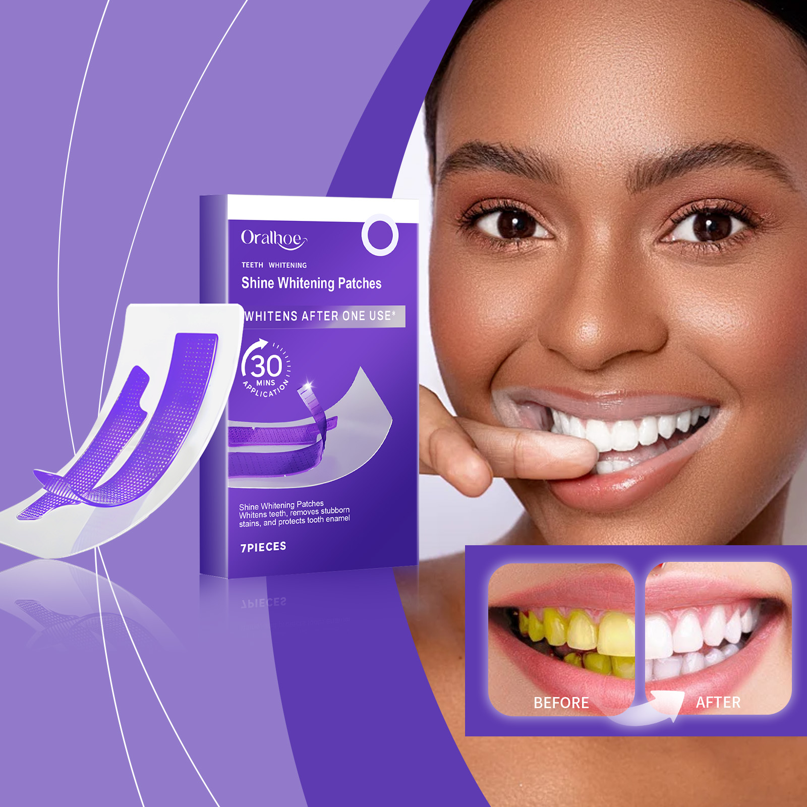 Paarse tandenbleekstrips – ver - Teeth Whitening Strips Crest recensie en prijs