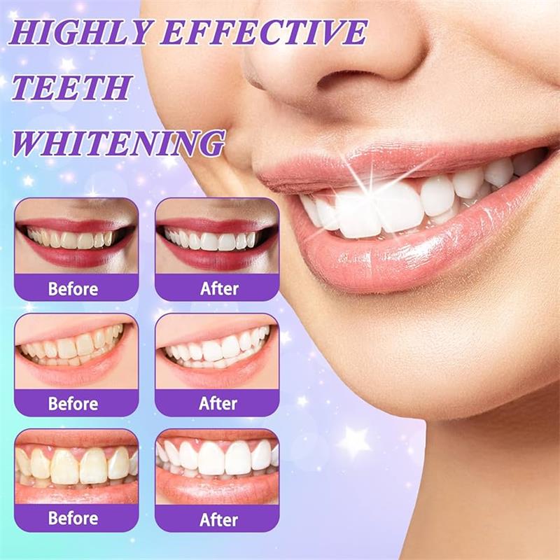 9D Paarse Tandenbleek Tandpast - Teeth Whitening Cream recensie en prijs