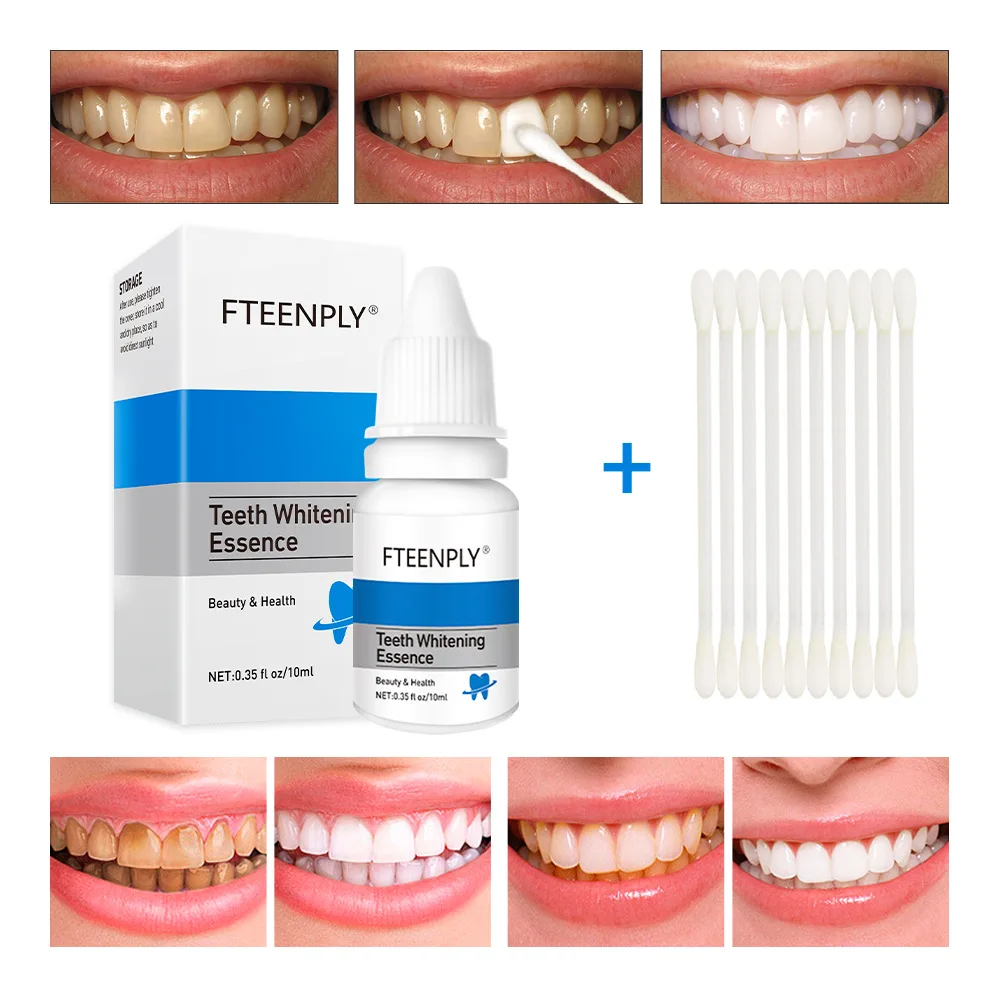 Fteenply Tanden Whitening Esse - Teeth Whitening Remedies recensie en prijs
