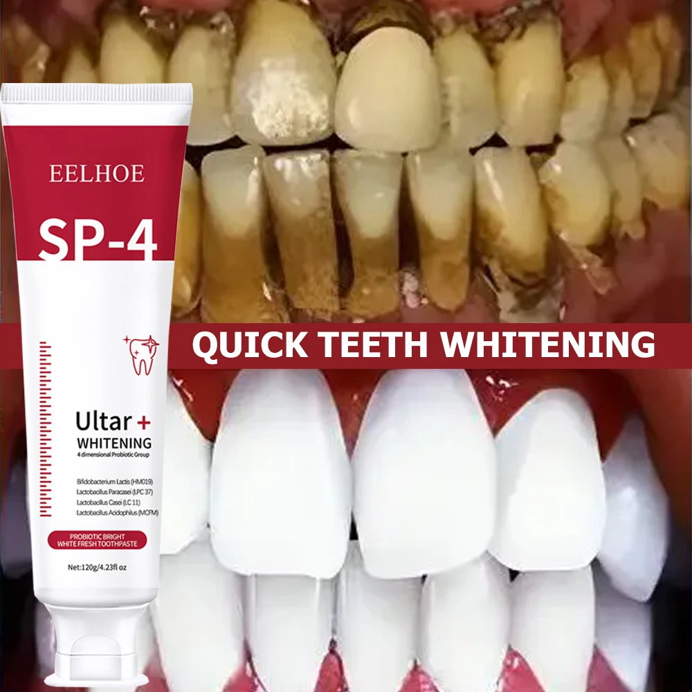 5 Stuks Sp-4 120G Probiotische - Teeth Whitening Enzymes recensie en prijs