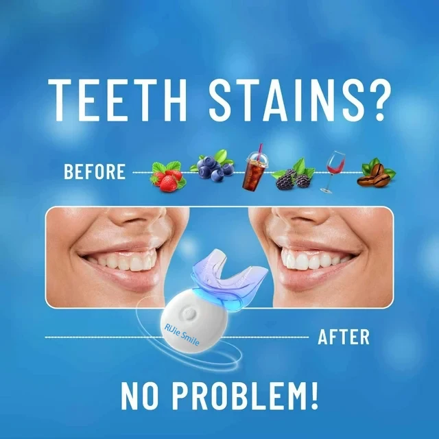 Hoogwaardige reinigingsset dra - Teeth Whitening Kit At Home recensie en prijs