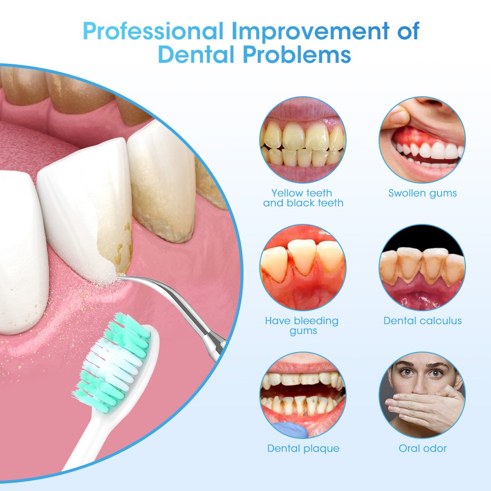 LC-H156X Elektrische Tanden Wh - Teeth Whitening And Stain Removal recensie en prijs