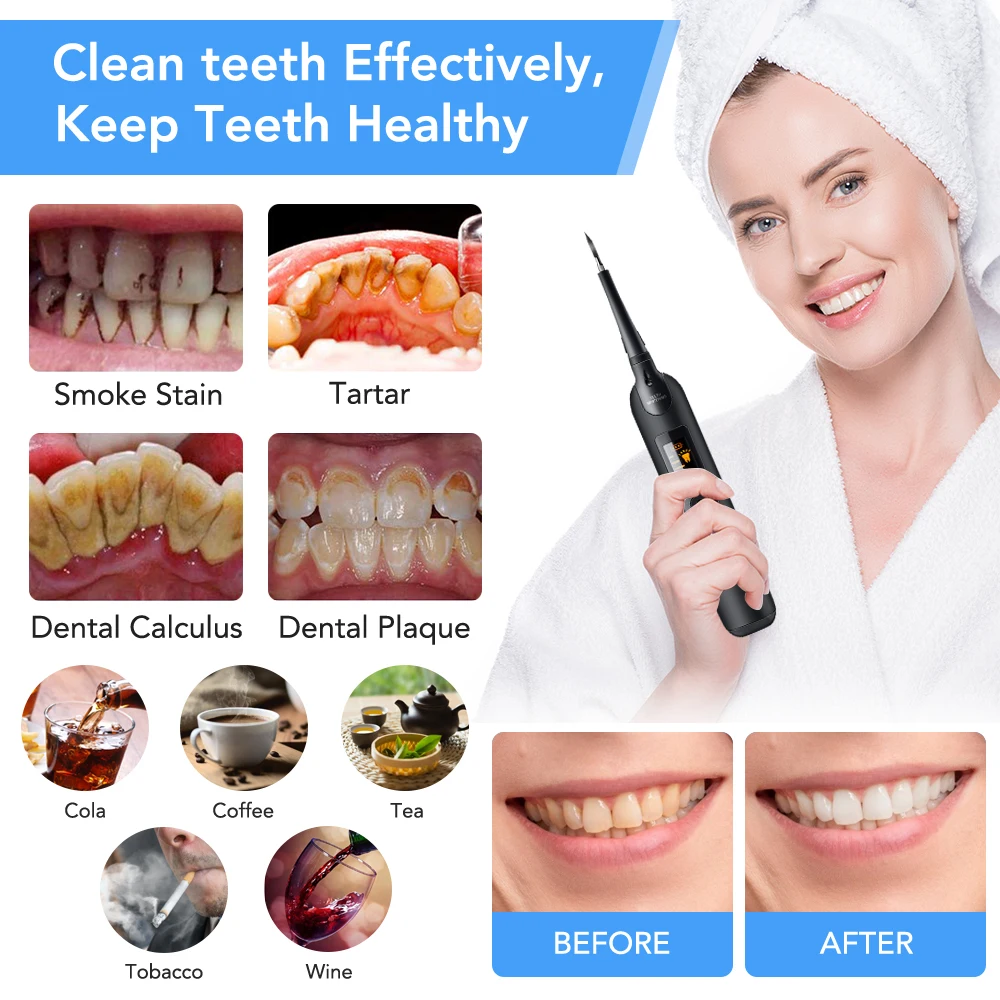 Elektrische Tandheelkundige Sc - Teeth Whitening Or Tooth Whitening recensie en prijs