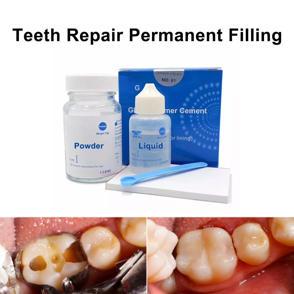 Permanente Tanden Vullen Repar - Teeth Whitening Kit At Home recensie en prijs