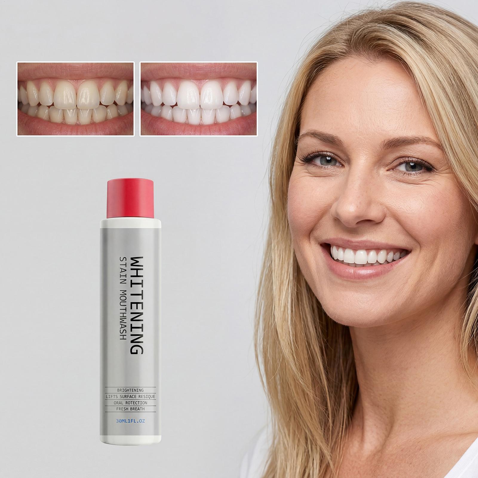 30ml Vlekkenverwijderende Mond - Teeth Whitening And Stain Removal recensie en prijs