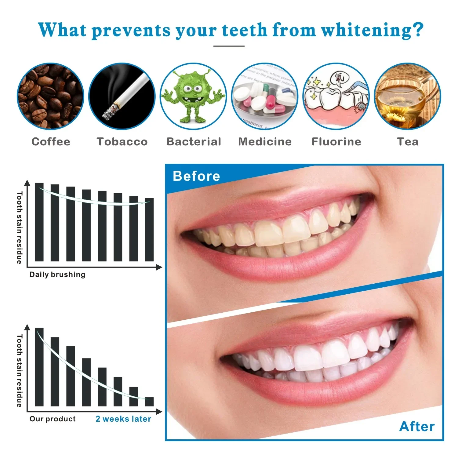14/28pcs 3D Tanden Whitening S - Whitening Strip 3D recensie en prijs