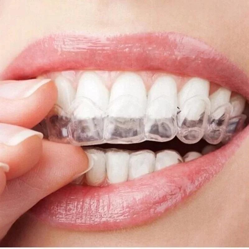 Professionele tandenbleekset,  - Teeth Whitening Kit At Home recensie en prijs