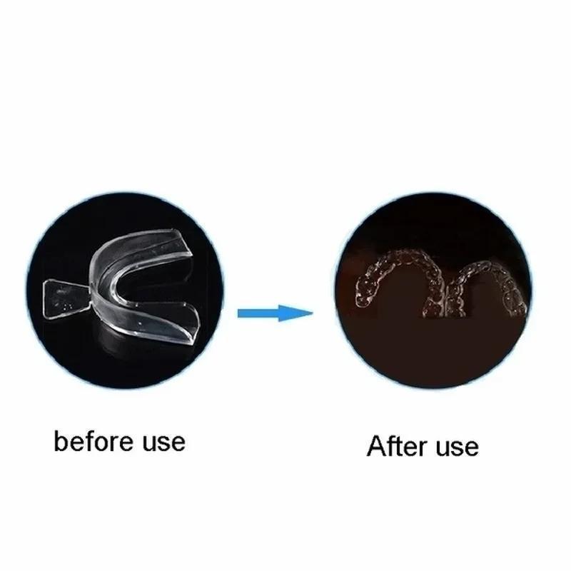 Professionele tandenbleekset,  - Teeth Whitening Kit At Home recensie en prijs