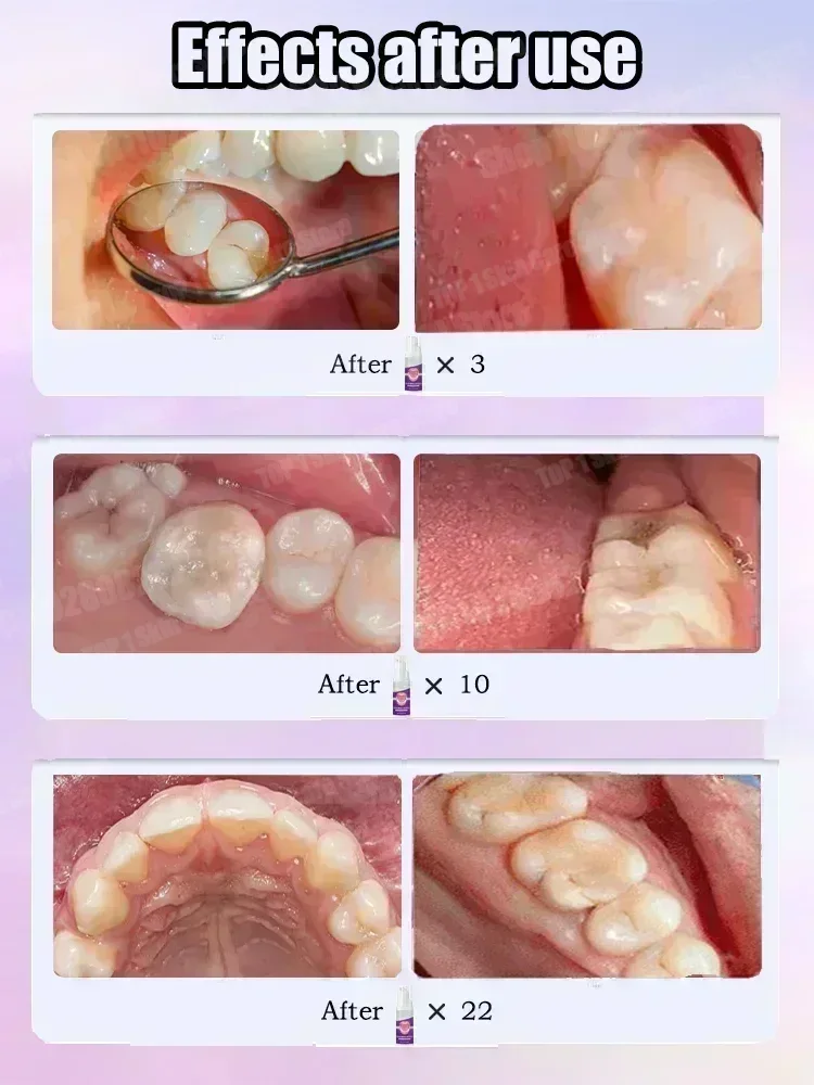 Hete verkoop Best verkochte, w - Teeth Whitening Cream recensie en prijs
