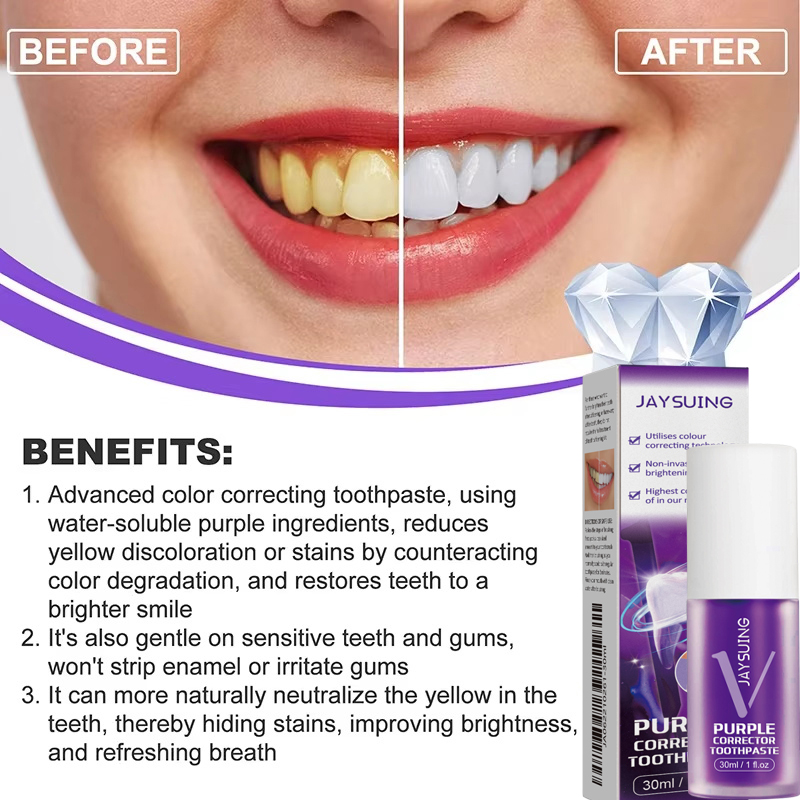 Tandenreiniging Whitening Tand - Teeth Whitening In Korea recensie en prijs