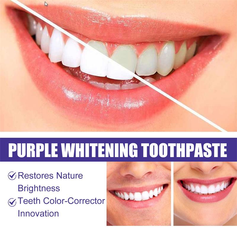 Tandenreiniging Whitening Tand - Teeth Whitening In Korea recensie en prijs