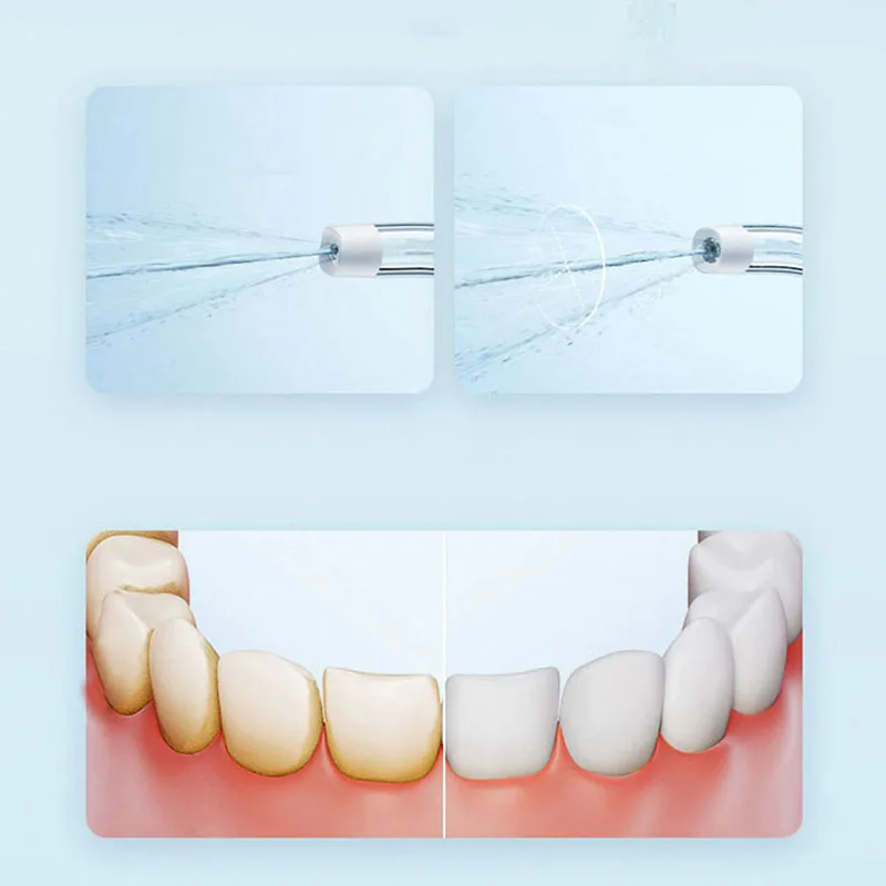 Xiaomi Draagbare Monddouche F3 - Teeth Whitening Or Tooth Whitening recensie en prijs