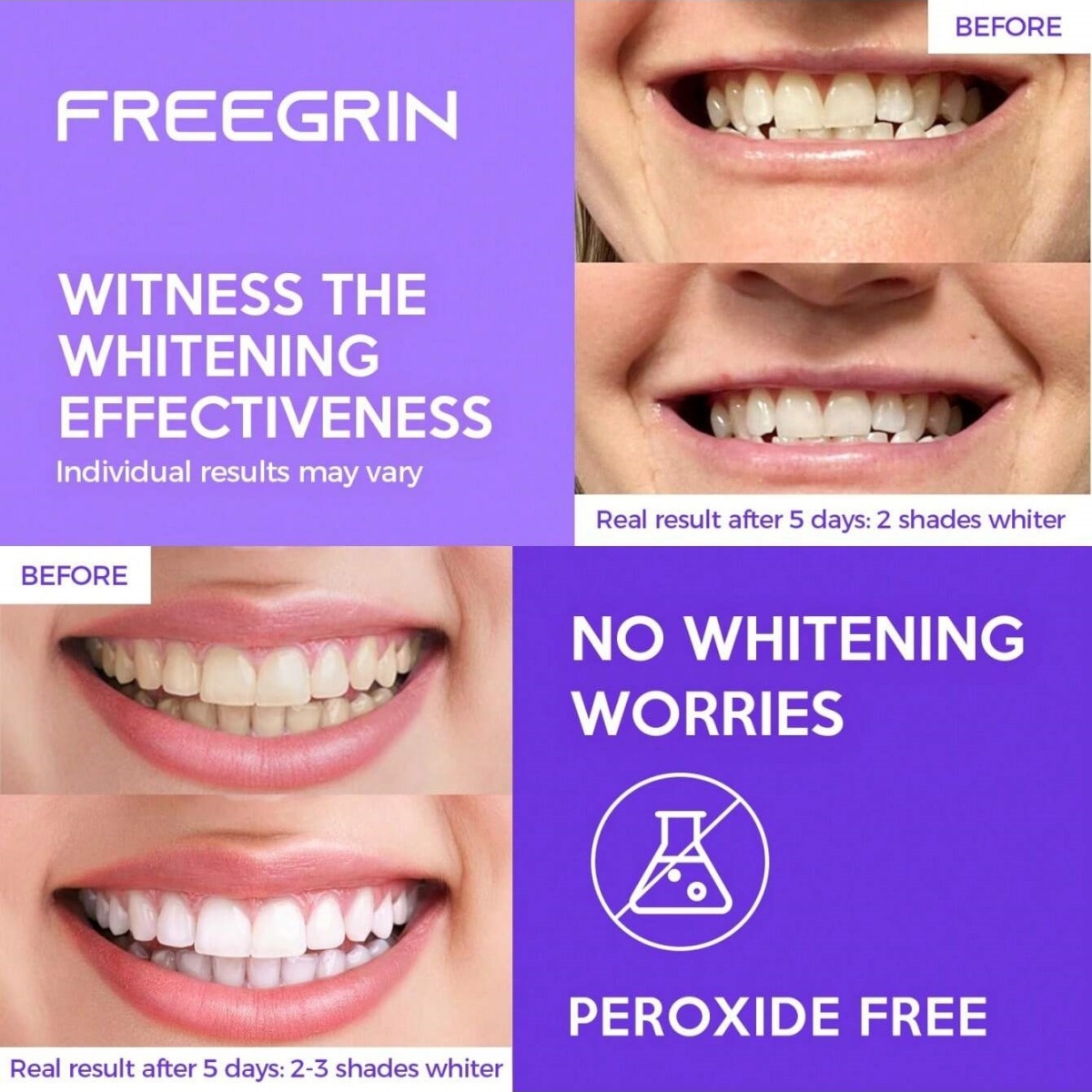 Deluxe Tanden Whitening Sticke - Teeth Whitening Gels Used By Dentists recensie en prijs