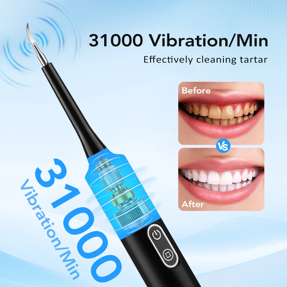 Elektrische sonische vibratie  - Teeth Whitening And Stain Removal recensie en prijs